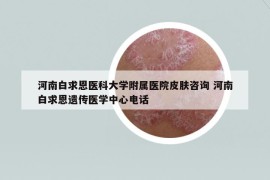 河南白求恩医科大学附属医院皮肤咨询 河南白求恩遗传医学中心电话