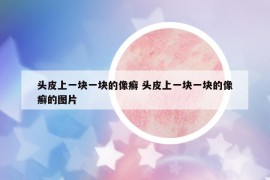 头皮上一块一块的像癣 头皮上一块一块的像癣的图片