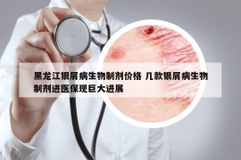 黑龙江银屑病生物制剂价格 几款银屑病生物制剂进医保现巨大进展