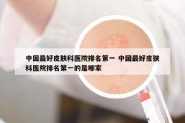 中国最好皮肤科医院排名第一 中国最好皮肤科医院排名第一的是哪家