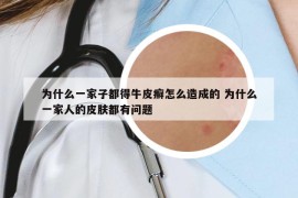 为什么一家子都得牛皮癣怎么造成的 为什么一家人的皮肤都有问题