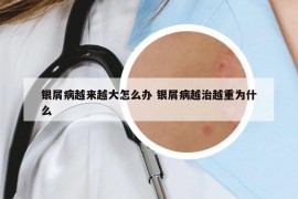 银屑病越来越大怎么办 银屑病越治越重为什么