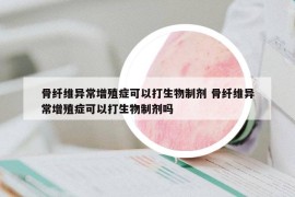 骨纤维异常增殖症可以打生物制剂 骨纤维异常增殖症可以打生物制剂吗