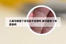 人被马蜂蜇了会引起牛皮癣吗 被马蜂蛰了会感染吗
