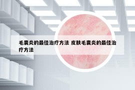 毛囊炎的最佳治疗方法 皮肤毛囊炎的最佳治疗方法