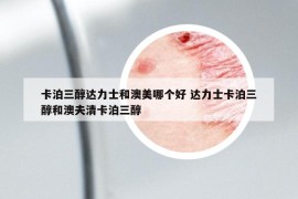 卡泊三醇达力士和澳美哪个好 达力士卡泊三醇和澳夫清卡泊三醇