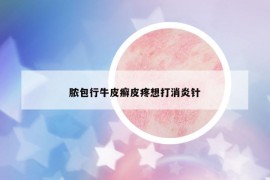 脓包行牛皮癣皮疼想打消炎针