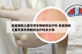 免疫缺陷儿童可用生物制剂治疗吗 免疫缺陷儿童可用生物制剂治疗吗多少钱