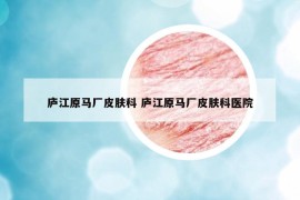 庐江原马厂皮肤科 庐江原马厂皮肤科医院