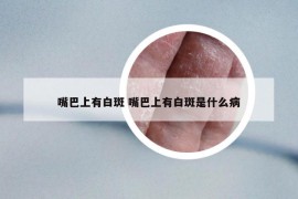 嘴巴上有白斑 嘴巴上有白斑是什么病