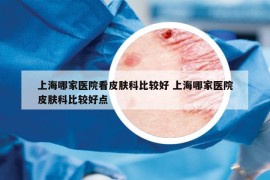 上海哪家医院看皮肤科比较好 上海哪家医院皮肤科比较好点