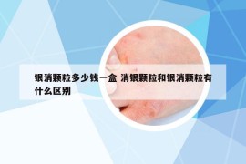 银消颗粒多少钱一盒 消银颗粒和银消颗粒有什么区别
