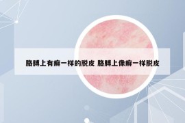 胳膊上有癣一样的脱皮 胳膊上像癣一样脱皮