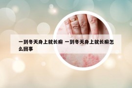 一到冬天身上就长癣 一到冬天身上就长癣怎么回事