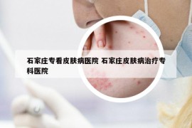 石家庄专看皮肤病医院 石家庄皮肤病治疗专科医院