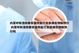 内蒙呼和浩特那家医院能打皮肤病生物制剂针 内蒙呼和浩特那家医院能打皮肤病生物制剂针吗