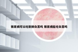 银屑病可以吃新鲜白蒿吗 银屑病能吃白蒿吗