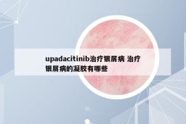 upadacitinib治疗银屑病 治疗银屑病的凝胶有哪些