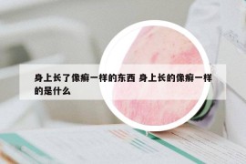 身上长了像癣一样的东西 身上长的像癣一样的是什么