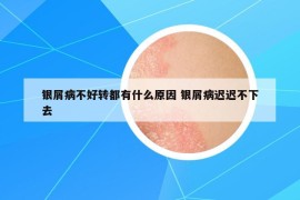 银屑病不好转都有什么原因 银屑病迟迟不下去