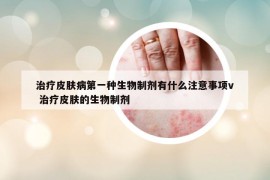 治疗皮肤病第一种生物制剂有什么注意事项v 治疗皮肤的生物制剂