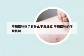 甲胺碟呤吃了有什么不良反应 甲胺蝶呤的作用机制