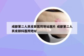 成都第二人民皮肤医院地址图片 成都第二人民皮肤科医院地址