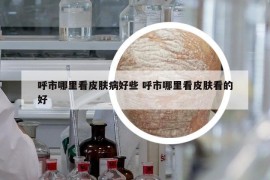 呼市哪里看皮肤病好些 呼市哪里看皮肤看的好
