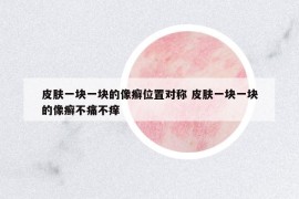 皮肤一块一块的像癣位置对称 皮肤一块一块的像癣不痛不痒