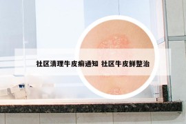 社区清理牛皮癣通知 社区牛皮鲜整治