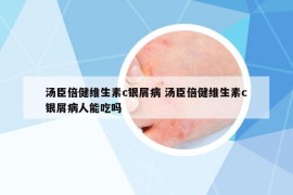 汤臣倍健维生素c银屑病 汤臣倍健维生素c银屑病人能吃吗
