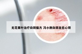 无花果叶治疗白斑偏方 冯小刚白斑自愈心得