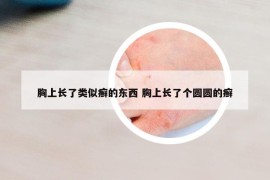 胸上长了类似癣的东西 胸上长了个圆圆的癣