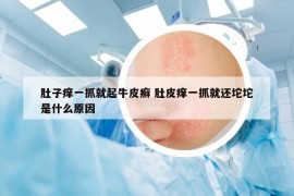 肚子痒一抓就起牛皮癣 肚皮痒一抓就还坨坨是什么原因