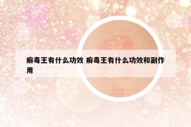 癣毒王有什么功效 癣毒王有什么功效和副作用