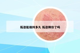 拓咨能维持多久 拓咨降价了吗