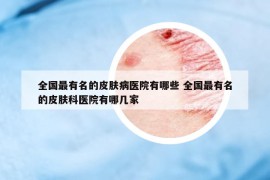 全国最有名的皮肤病医院有哪些 全国最有名的皮肤科医院有哪几家