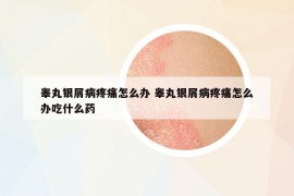 睾丸银屑病疼痛怎么办 睾丸银屑病疼痛怎么办吃什么药