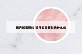 银丹解毒颗粒 银丹解毒颗粒治什么病