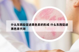 什么东西能促进黑色素的形成 什么东西促进黑色素代谢