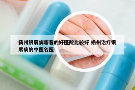 扬州银屑病哪看的好医院比较好 扬州治疗银屑病的中医名医