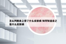 怎么判断身上得了什么皮肤病 如何知道自己是什么皮肤病