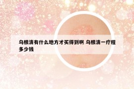 乌根清有什么地方才买得到啊 乌根清一疗程多少钱