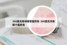308激光郑州哪家医院有 308激光河南哪个医院有
