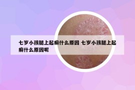 七岁小孩腿上起癣什么原因 七岁小孩腿上起癣什么原因呢