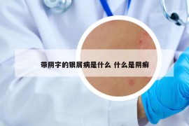 带阴字的银屑病是什么 什么是阴癣
