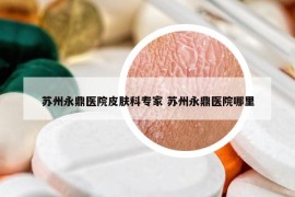 苏州永鼎医院皮肤科专家 苏州永鼎医院哪里