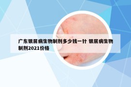 广东银屑病生物制剂多少钱一针 银屑病生物制剂2021价格