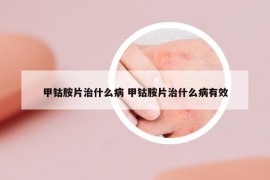 甲钴胺片治什么病 甲钴胺片治什么病有效