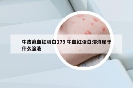 牛皮癣血红蛋白179 牛血红蛋白溶液属于什么溶液